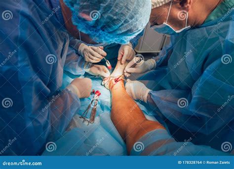 Process of Trauma Surgery Operation. Group of Surgeons in Operating Room Stock Photo - Image of ...