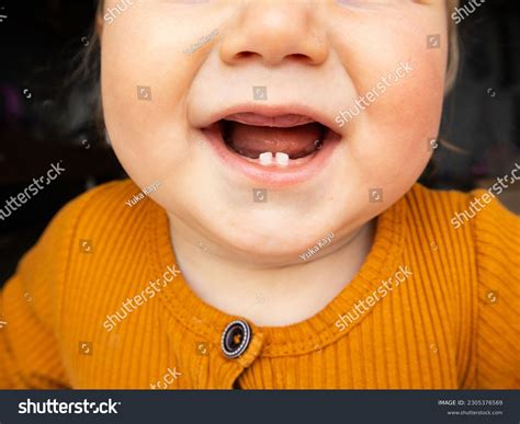 Cild And Dentist: Over 1 Royalty-Free Licensable Stock Photos | Shutterstock