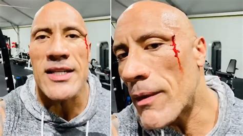 Agency News | Dwayne Johnson AKA The Rock Suffers Face Injury During ...