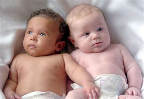 Superfecundation & Superfeotation: Twins with Different Fathers ...