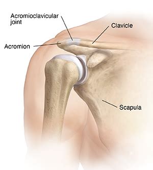 Understanding AC Joint Sprain | Saint Luke's Health System