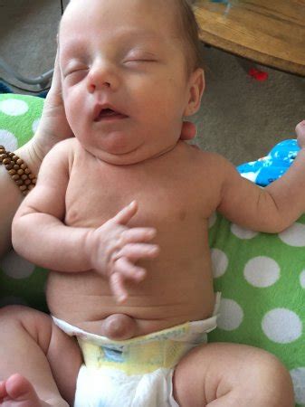 Outie belly button | BabyCenter
