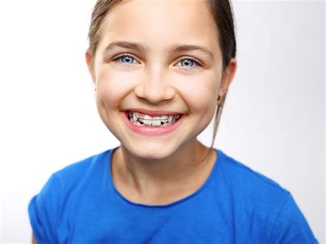 What is the Best Way to Fix Overlapping Teeth? - Pediatric Dental Center