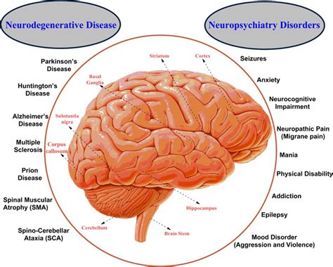 Human Brain Disorders: A Review