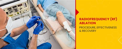 Radio frequency (RF) Ablation: Procedure, Effectiveness, and Recovery