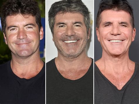 Simon Cowell Says I'm Done With Botox, Made Me Look Like 'Horror Film'