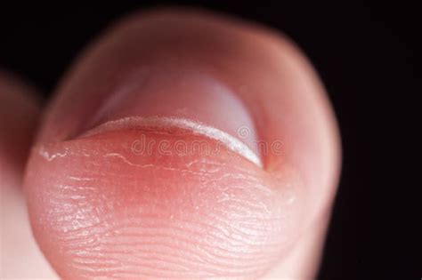 Nail on Human Finger Close Up, Macro Stock Image - Image of close ...