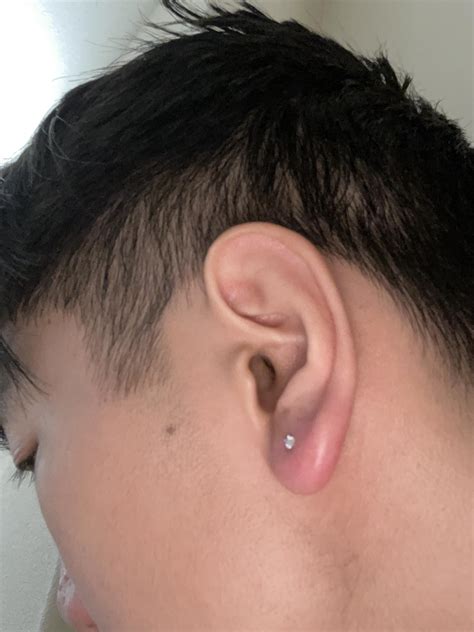 Earlobe infection, serious or not? : r/piercing