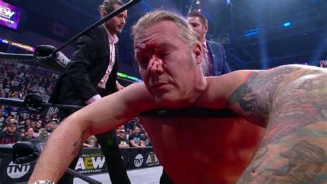 Chris Jericho Needed 7 Stitches After Last Night's AEW Dynamite