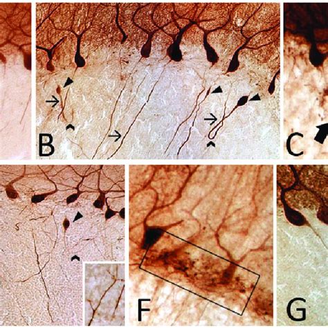 Calbindin immunohistochemistry on 100-mm cerebellar neocortex sections ...