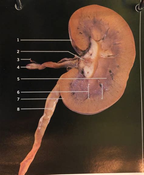 Sheep Kidney Dissection Labeled - vrogue.co