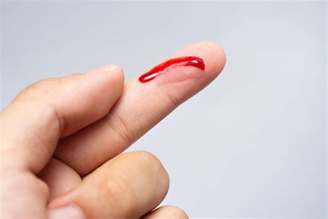 Bleeding Cut Images – Browse 18,709 Stock Photos, Vectors, and Video ...