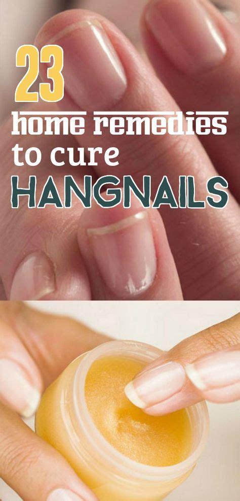 23 Effective Home Remedies to Get Rid of Hangnails | Hangnail, Nail remedies, Hangnail treatment