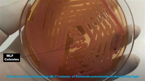 MacConkey Agar: Introduction, Principle, Composition, Preparation, Proc