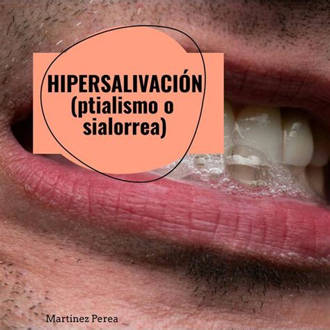 Hipersalivación (ptilismo o sialorrea) | Mauro Martinez | uDocz