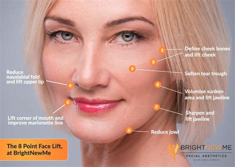 The 8-Point Face Lift for a refreshed, rejuvenated look | Facial aesthetics, Facelift, Face fillers