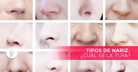 Tipos de Nariz - Clinica Saint Paul - Dr. Edwin Vásquez Ph.D.