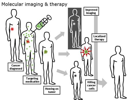 Nanotheranostics – Simultaneous Use Of Nanomedicine-Based Therapeutic ...