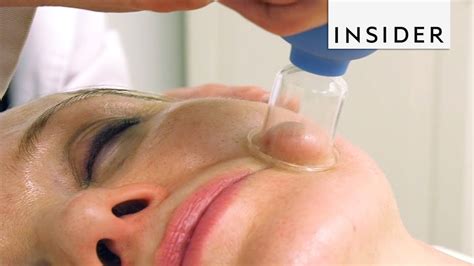 Face Cupping Gives Instant Facelift - YouTube