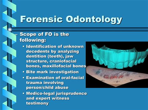 PPT - Medico-legal Investigation PowerPoint Presentation, free download ...