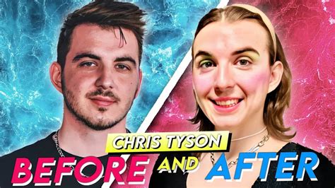 Chris Tyson | Before & After | MrBeast's Co-Star HRT Transformation