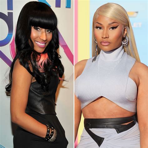 Nicki Minaj Plastic Surgery Before : Unveiling the Jaw-Dropping Transformation