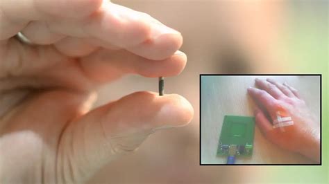 Thousands of Swedes Sign Up to Have Microchips Implanted Under Their Skin | AltHealthWorks.com