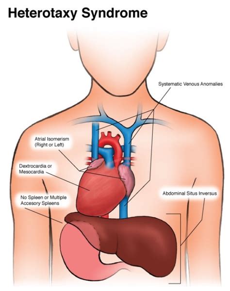 Post Delivery Graphic Anatomy | OB Images