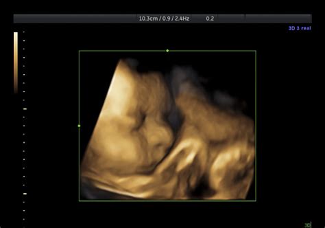 Baby 3d Ultrasound Stock Photo - Download Image Now - iStock