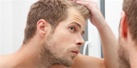 7 Natural Hair Regrowth Tips For Men