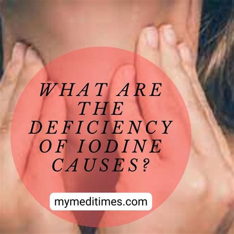 What Are the deficiency of iodine causes? - My Medi Times