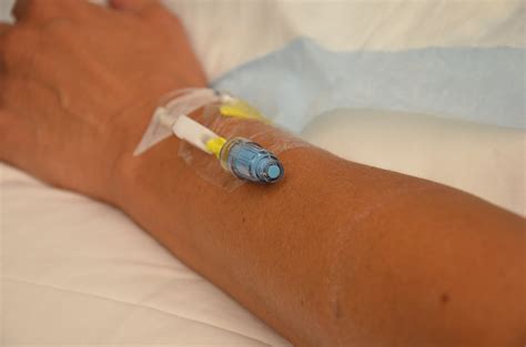 8.6 Converting an IV Infusion to a Saline Lock and Removal of a ...