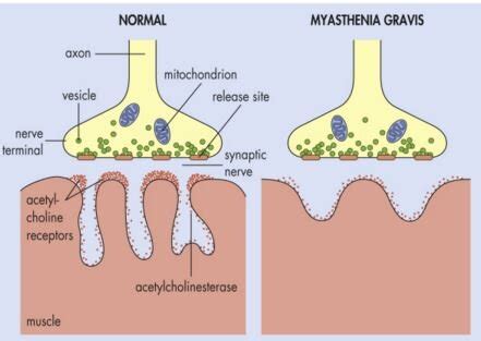 What is the molecular mechanism of tensilon? — Brain Stuff