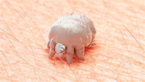 16 Mysterious Microscopic Bugs That Bite (And Easy Solutions)