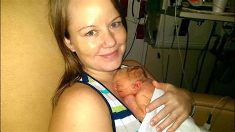 Baby born without a complete skull defies the odds - East Idaho News