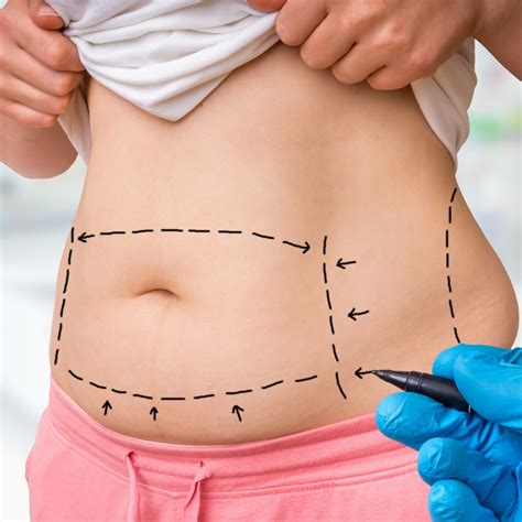 Autologous Fat Transfer Atlanta | Fat Grafting | Women's Health Specialists