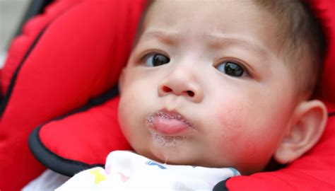 bad baby drool rash treatment - Hit A Home Run Biog Picture Galleries