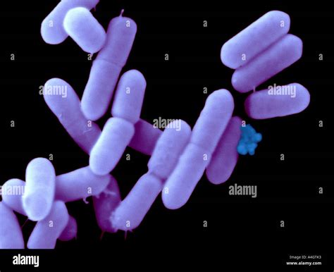 Listeria Monocytogenes Gram Stain Images - img-Aaralyn