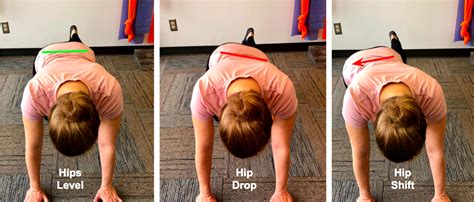 Another Look at Hip Drop — Precision Physical Therapy