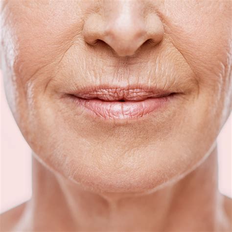 Achieve a Youthful Smile: Exploring the Best Treatment for Wrinkles Above Lips - Flash Uganda Media