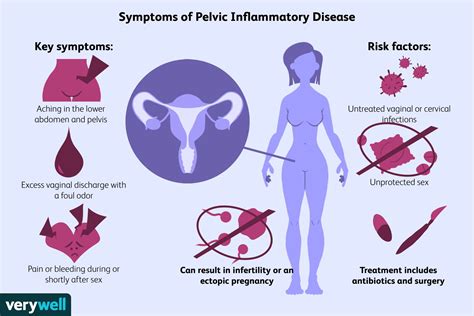 Pelvic Inflammatory Disease: Symptoms, Causes, Treatment