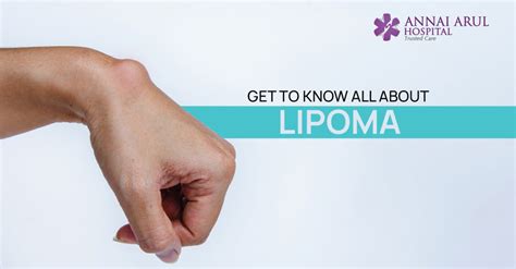 GET TO KNOW ALL ABOUT LIPOMA – Multispeciality Hospitals in Chennai