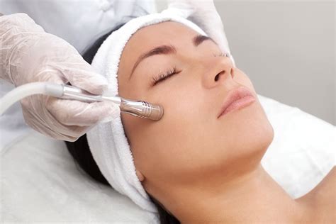 Dermabrasion for Acne Scars: Is It Right for You?