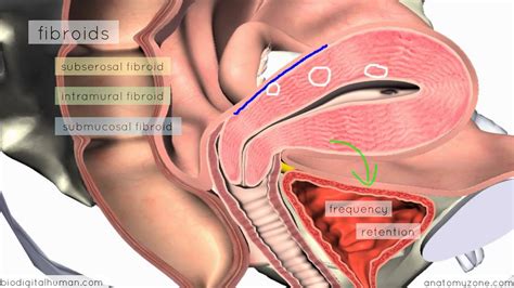 Clinical Reproductive Anatomy - Uterus - 3D Anatomy Tutorial - YouTube