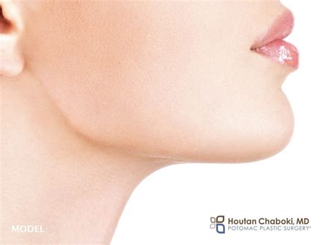 Chin Plastic Surgery in Women