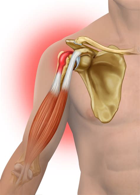 Distal Biceps | Orthopedic Centers of Colorado