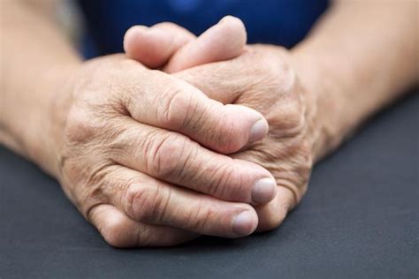 How (and When) Hand Surgery Can Help Your Arthritis: Twin Palm ...