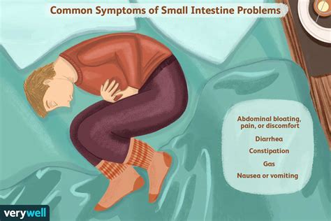 Diarrhea and Other Lower Intestinal Fluid Losses Will Contribute to