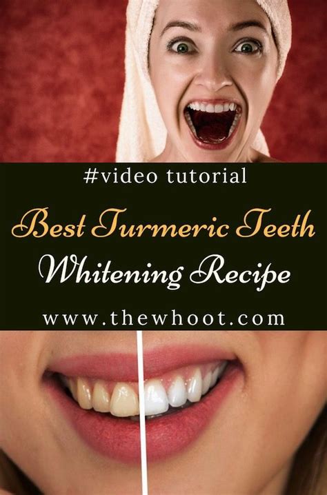 Turmeric Teeth Whitening Recipe Easy Video Tutorial | Nana's Treasures | Natural teeth whitening ...