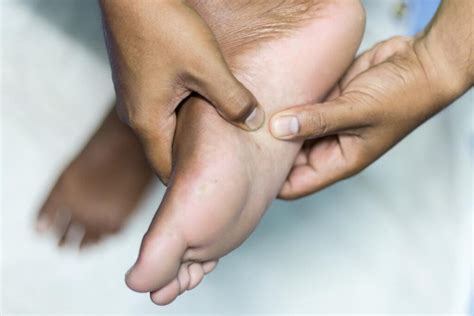 Plantar Fibroma - Symptoms & Causes